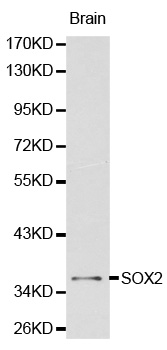 Anti-SOX2 Antibody