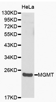 Anti-MGMT Antibody