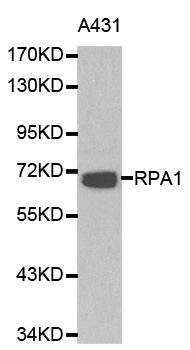 Anti-RPA1 Antibody