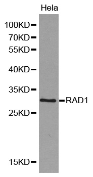 Anti-RAD1 Antibody