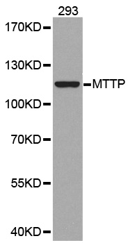 Anti-MTTP Antibody