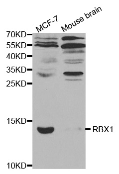 Anti-RBX1 Antibody
