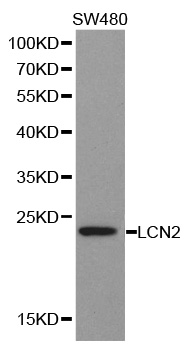 Anti-LCN2 Antibody