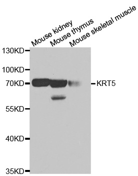 Anti-KRT5 Antibody