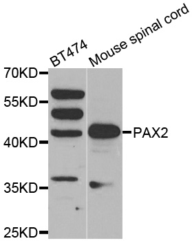 Anti-PAX2 Antibody