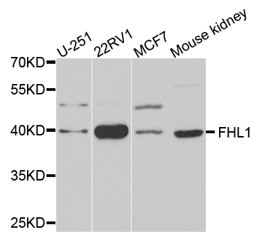 Anti-FHL1 Antibody