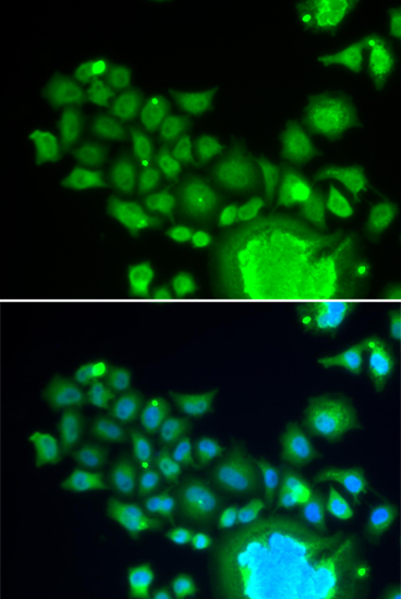 Anti-FZR1 Antibody
