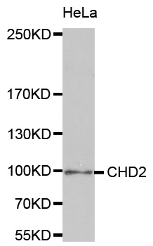Anti-CHD2 Antibody