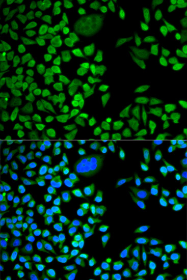 Anti-TIA1 Antibody Anti-TIA1 Antibody