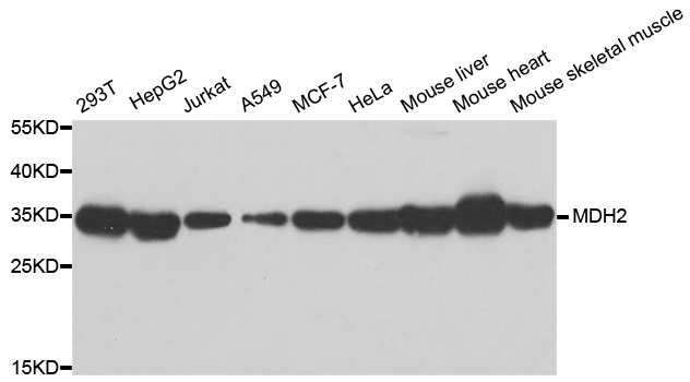 Anti-MDH2 Antibody