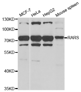 Anti-RARS Antibody