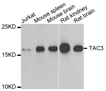 Anti-TAC3 Antibody