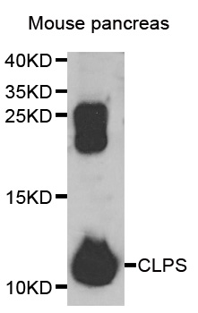 Anti-CLPS Antibody