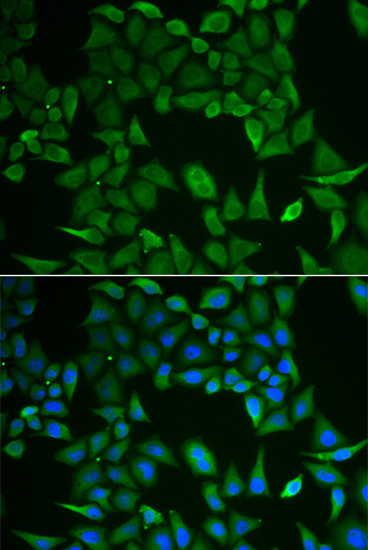 Anti-CLPS Antibody Anti-CLPS Antibody