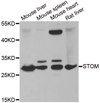 Anti-STOM Antibody