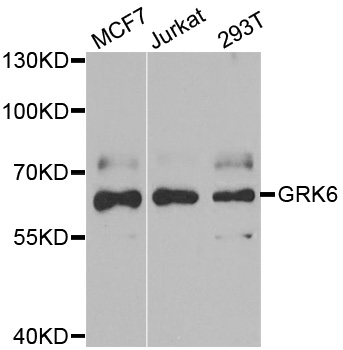 Anti-GRK6 Antibody