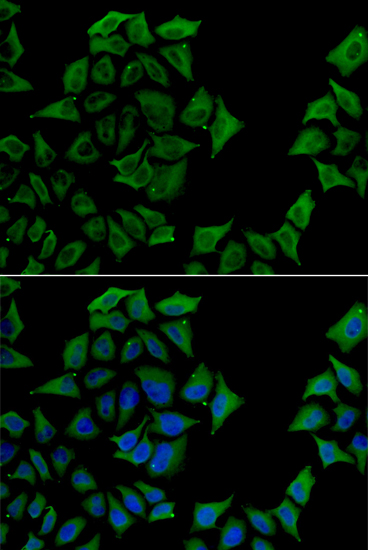 Anti-TCN1 Antibody Anti-TCN1 Antibody