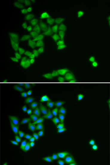 Anti-PJA2 Antibody
