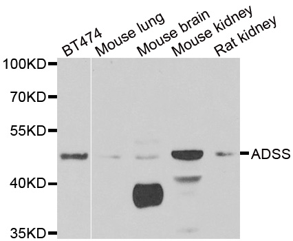 Anti-ADSS Antibody