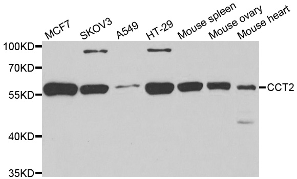 Anti-CCT2 Antibody