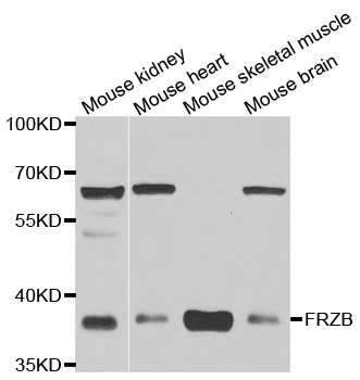 Anti-FRZB Antibody