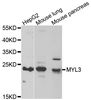 Anti-MYL3 Antibody