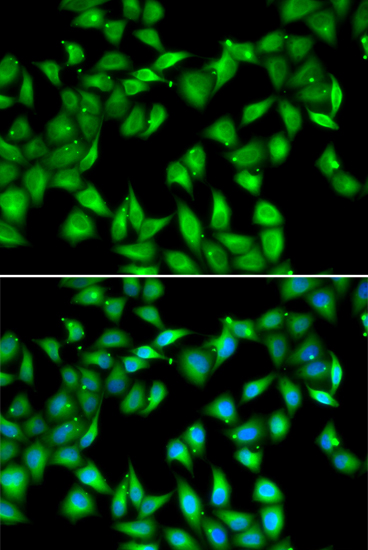 Anti-MYL3 Antibody Anti-MYL3 Antibody