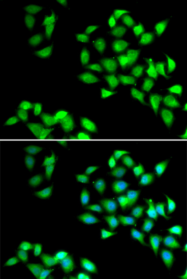 Anti-NNMT Antibody Anti-NNMT Antibody