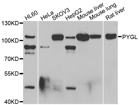 Anti-PYGL Antibody