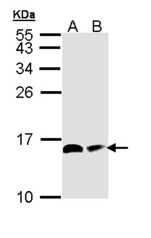 Anti-ACP Antibody