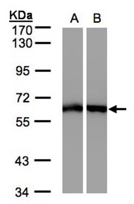 Anti-ME1 Antibody