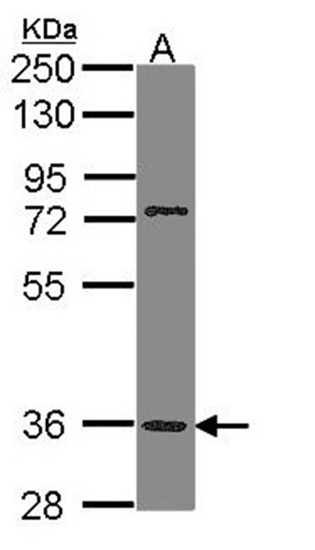 Anti-PNR Antibody