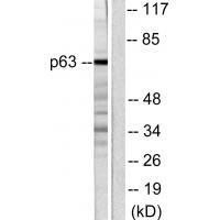Anti-p63 Antibody Anti-p63 Antibody