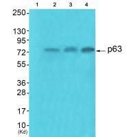 Anti-p63 Antibody Anti-p63 Antibody
