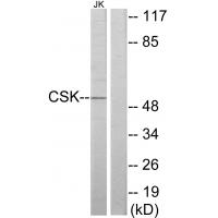 Anti-CSK Antibody