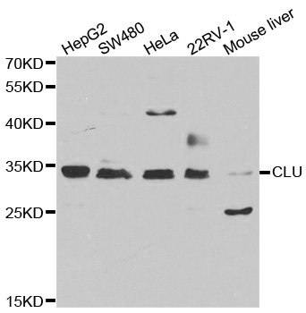 Anti-CLU Antibody