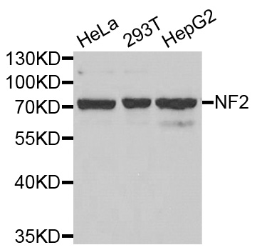 Anti-NF2 Antibody