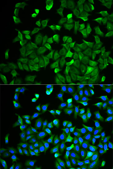 Anti-NF2 Antibody Anti-NF2 Antibody