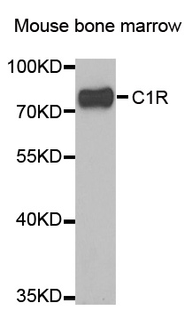 Anti-C1R Antibody