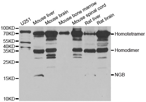 Anti-NGB Antibody