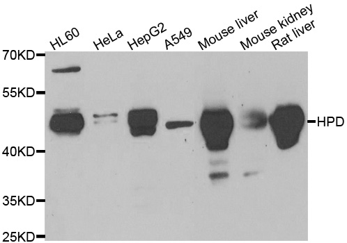 Anti-HPD Antibody