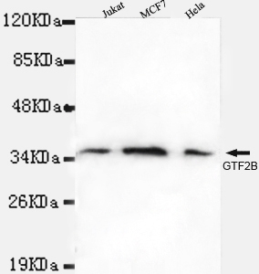 Anti-TFIIB Antibody