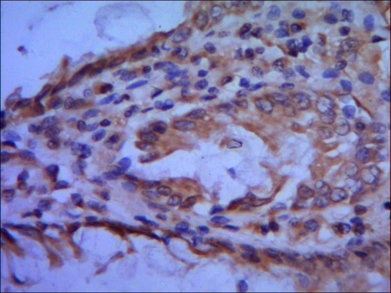 Anti-TFIIB Antibody Anti-TFIIB Antibody