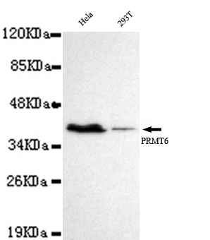 Anti-PRMT6 Antibody