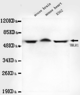 Anti-TBLR1 Antibody
