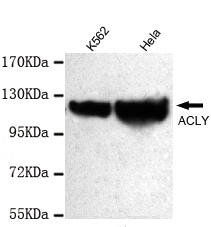 Anti-ATP-Citrate Lyase (C-term) Antibody
