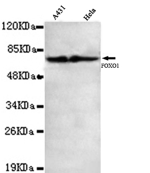 Anti-FOXO1 Antibody