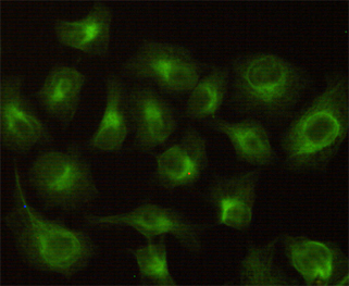 Anti-CBR1 Antibody