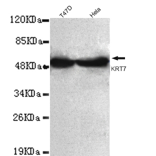 Anti-Keratin 7 (C-term) Antibody