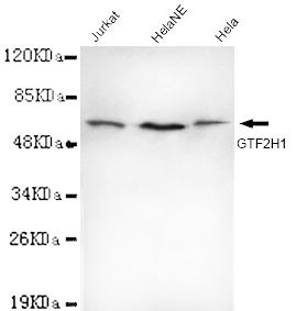 Anti-TFIIH (N-term) Antibody